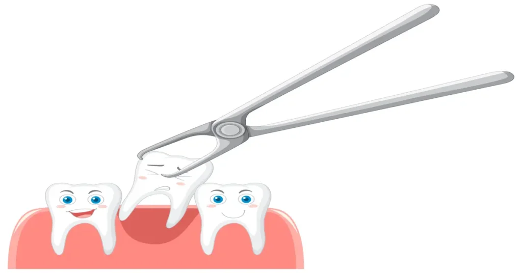 What to Do After Tooth Extraction for Safe and Smooth Recovery