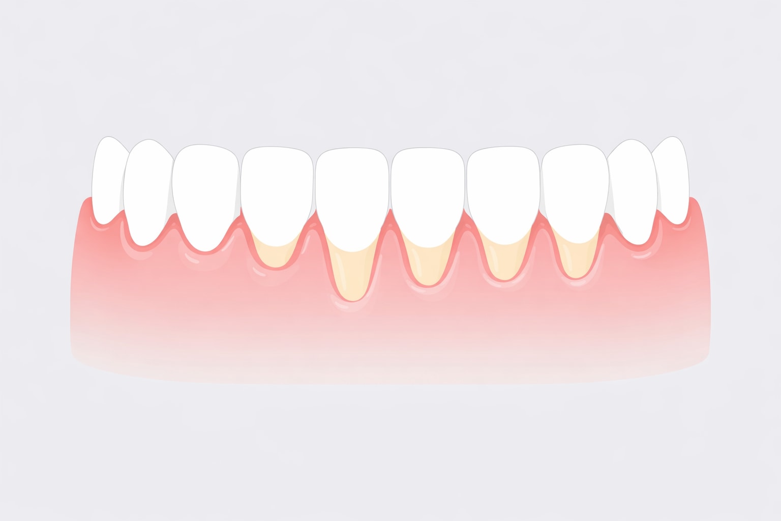 What Is Good for Receding Gums